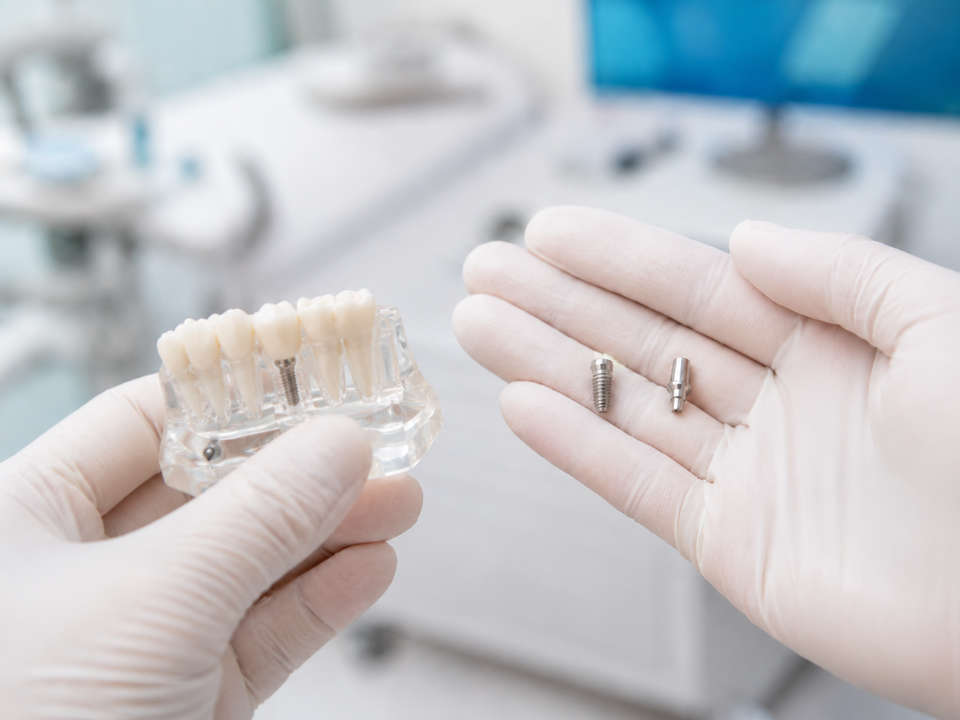 Implantología oral en Prodental Fuenlabrada